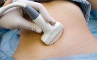 Ultrasound-Reduces-Complications-in-Central-Line-Placement-seattle