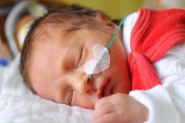 Newborn baby sleeping after receiving Cerebral Palsy Treatments